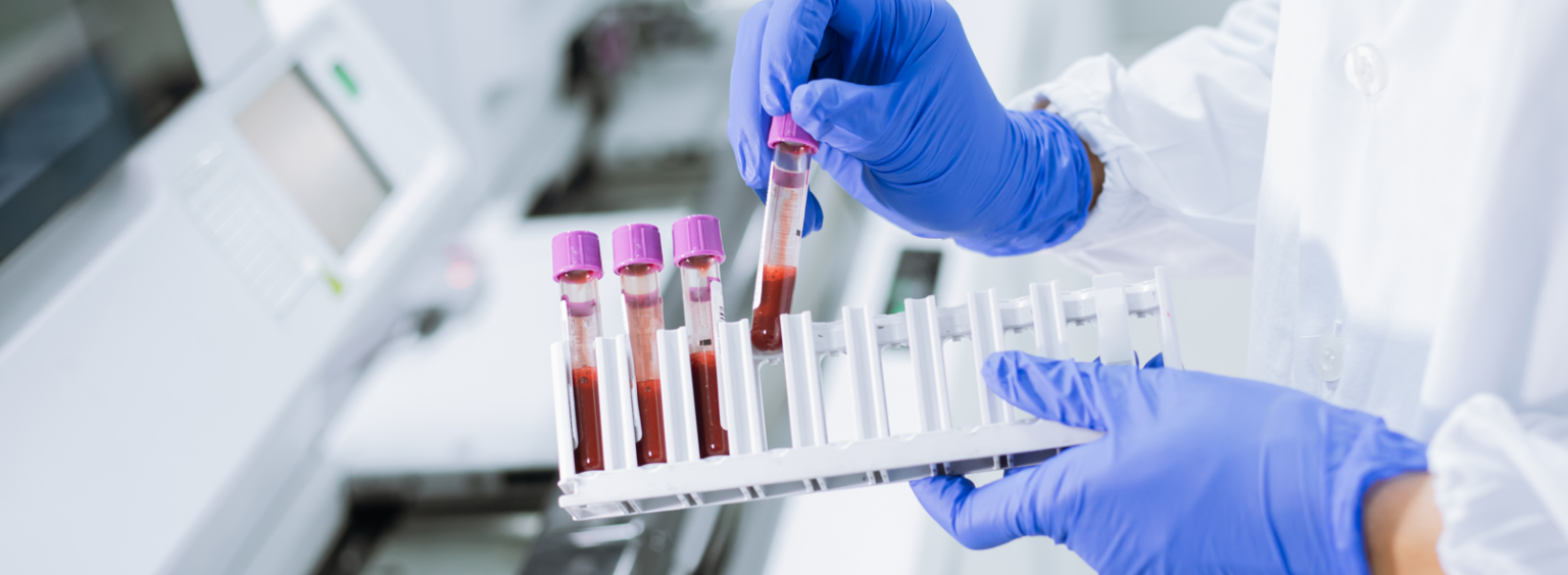 Attorney for DUI Blood Testing in Tampa, Hillsborough County, FL