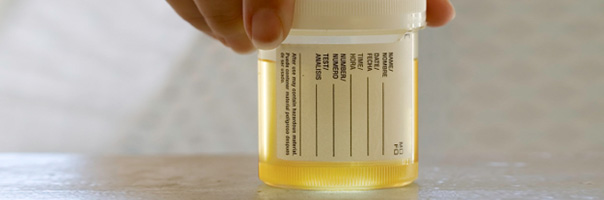 Urine Test